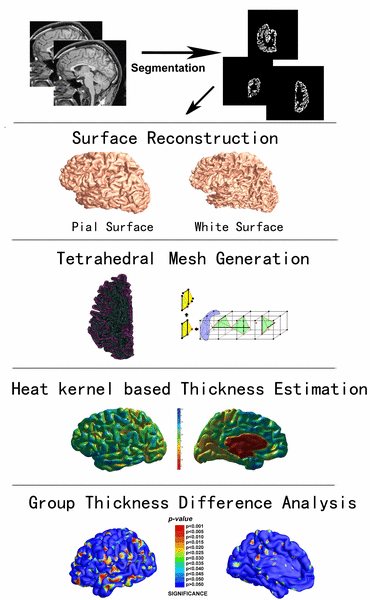 Image of A Novel Cortical Thickness Estimation Method based on Volumetric Laplace-Beltrami Operator and Heat Kernel