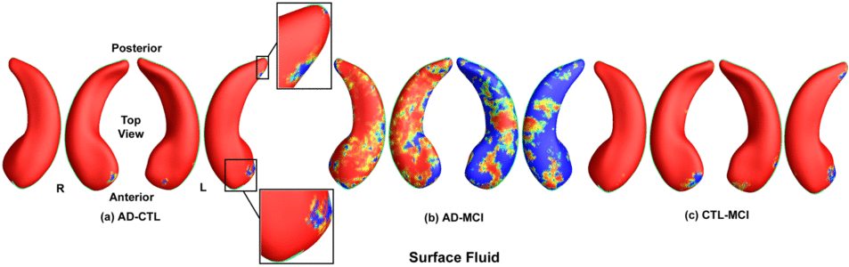 Image of Surface Fluid Registration of Conformal Representation: Application to Detect Disease Burden and Genetic Influence on Hippocampus
