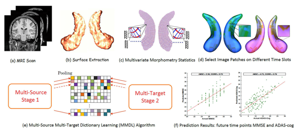 Image of Multi-source Multi-target Dictionary Learning for Prediction of Cognitive Decline
