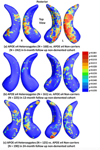 Image of Influence of APOE Genotype on Hippocampal Atrophy over Time - An N=1925 Surface-based ADNI Study