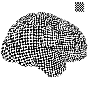 Image of Brain Surface Conformal parameterization with the Ricci Flow
