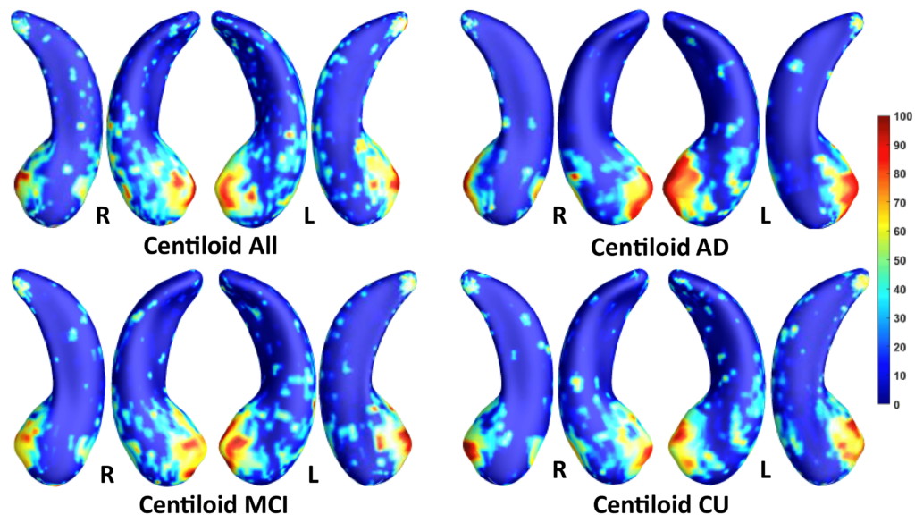 Image of Federated Morphometry Feature Selection for Hippocampal Morphometry Associated Beta-Amyloid and Tau Pathology

