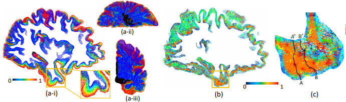 Image of Tetrahedral Spectral Feature-Based Bayesian Manifold Learning for Grey Matter Morphometry: Findings from the Alzheimer’s DiseaseNeuroimaging Initiative