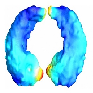 Image of Brain Surface Registration

