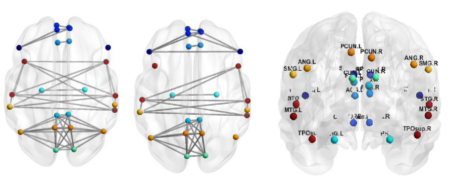 Default Mode Network Analysis of APOE Genotype in Cognitively Unimpaired Subjects Based on Persistent Homology, 