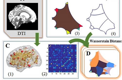 Enhancing Diffusion MRI Measures By Integrating Grey And White Matter Morphometry With Hyperbolic Wasserstein Distance