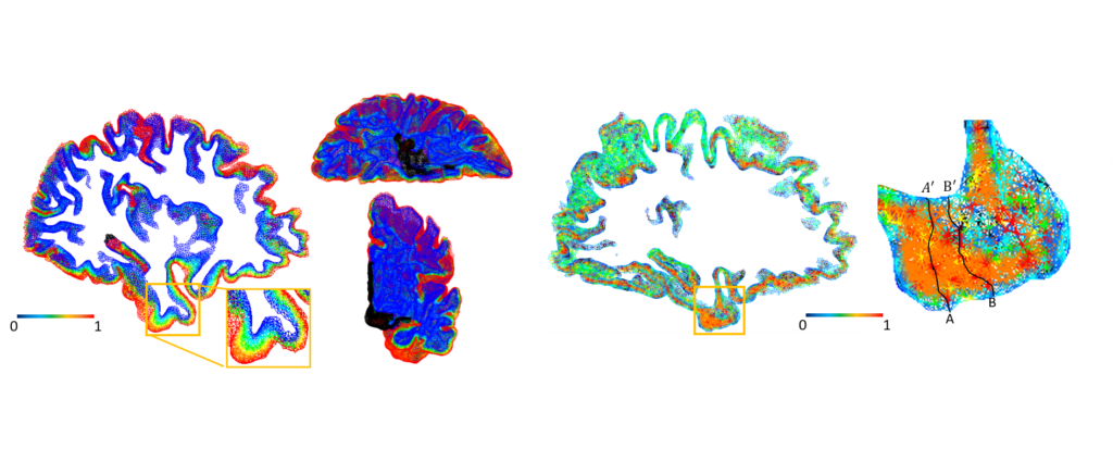Tetrahedral Spectral Feature-Based Bayesian Manifold Learning for Grey Matter Morphometry: Findings from the Alzheimer’s DiseaseNeuroimaging Initiative, 
