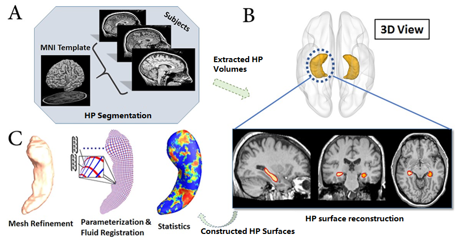 APPLYING SURFACE-BASED HIPPOCAMPAL MORPHOMETRY TO STUDY APOE-E4 ALLELE DOSE EFFECTS IN COGNITIVELY UNIMPAIRED SUBJECTS