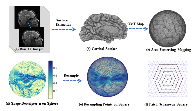 Image of EMBC2018: We proposed a novel isometry invariant shape descriptor,  based on area-preserving mapping, for brain morphometry analysis to help assess Alzheimer's Disease influence on cortical surface.  Our method out-performs the Spherical Harmonic, weighted Spherical Harmonic, and Freesurfer thickness based methods on a dataset with 